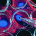 Abu Dhabi stem cell therapy project